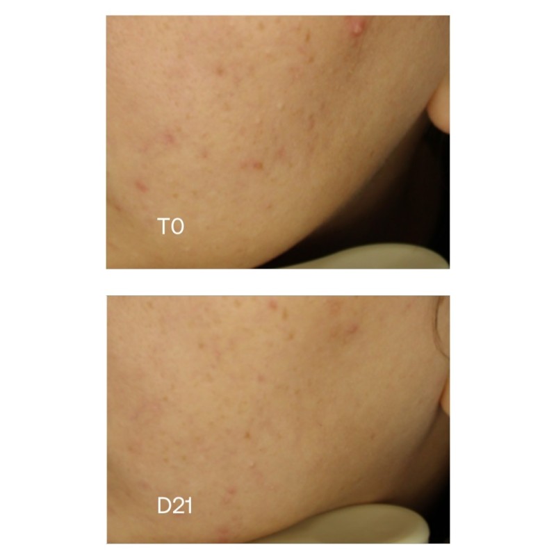 Sensilis Pure 15AZ Concentrado 30 ml | Farmacia Liceo