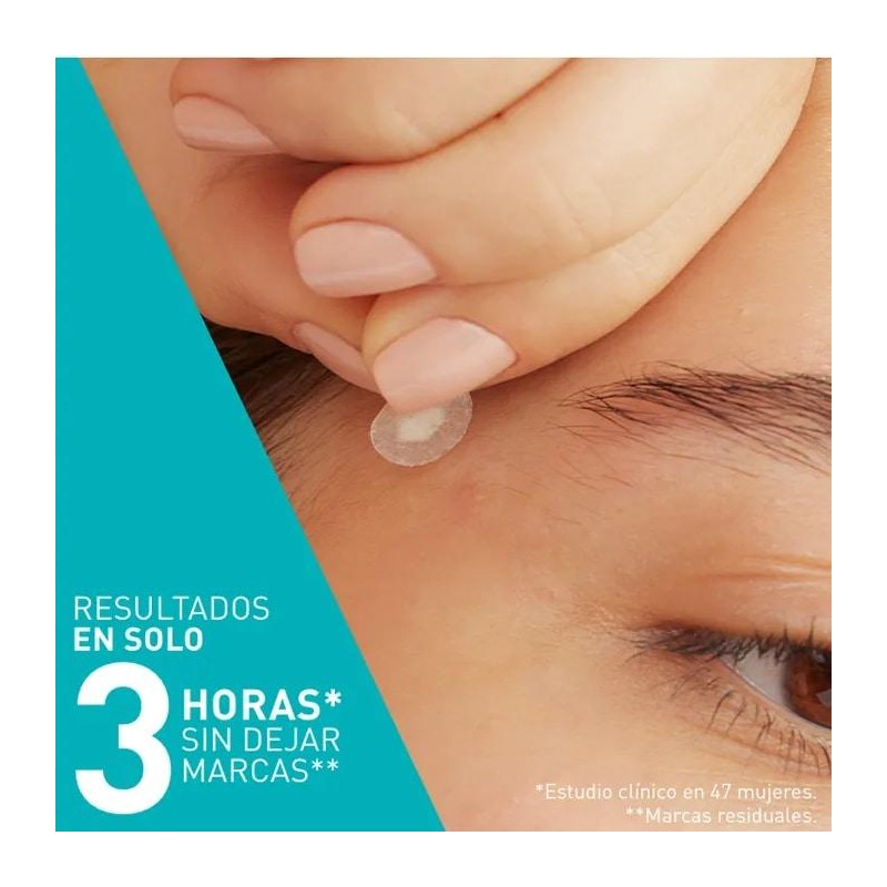 Cerave Parches Anti Granos