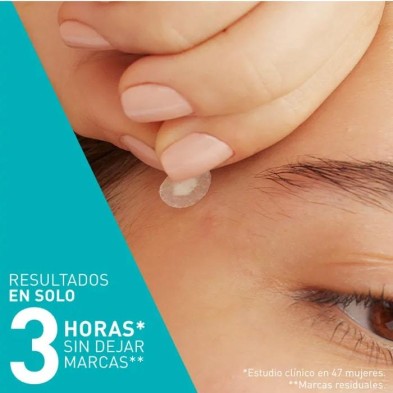 Cerave Parches Anti Granos