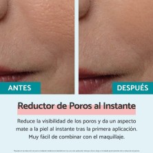 REMESCAR REDUCTOR DE POROS 20 ML